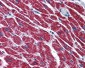 SCHAD / HADHSC Antibody (clone 4B5)